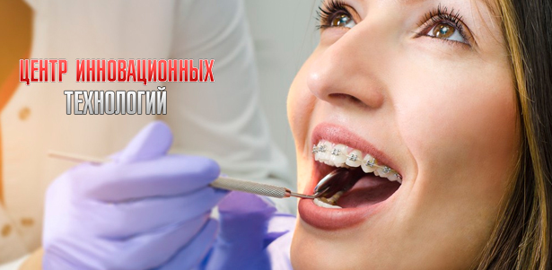 Металлические, сапфировые, керамические и невидимые брекет-системы в клинике эстетической стоматологии «Центр инновационных технологий». **Скидка до 73%**. Санкт-Петербург - kupikupon.ru Металлические, сапфировые, керамические и невидимые брекет-системы в клинике эстетической стоматологии «Центр инновационных технологий». **Скидка до 73%**