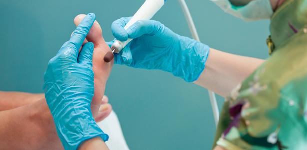 Медицинский аппаратный педикюр в инновационном центре здоровья «Санатера». **Скидка 80%**
