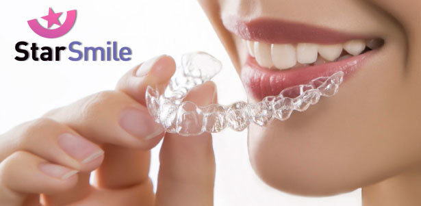 Альтернатива брекет-системам! Невидимые тестовые элайнеры от компании Star Smile **со скидкой 97%**