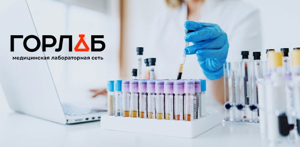 Комплексное исследование крови в медицинской лаборатории «Горлаб» на «Щелковской»: «Биохимия крови», «Обследование сердечно-сосудистой системы», «Онкологический комплекс для женщин» и не только. **Скидка 50%**
