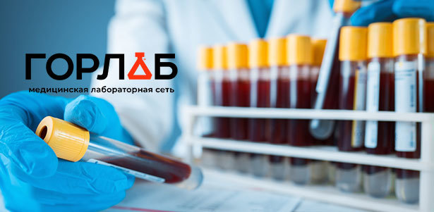 Комплексное исследование крови в медицинской лаборатории «Горлаб» на «Динамо»: «Онкологический комплекс для женщин», «Биохимия крови», «Обследование щитовидной железы» и не только. **Скидка 50%**