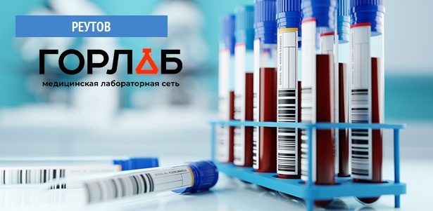 Комплексное исследование крови в медицинской лаборатории «Горлаб» в Реутове: «Биохимия крови», «Обследование щитовидной железы», «Онкологический комплекс для женщин» и не только. **Скидка 50%**